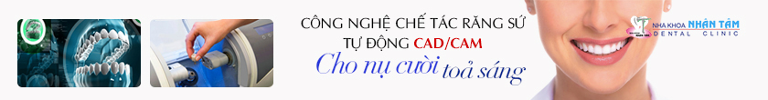 Răng đẹp hết ý - Không lo chi phí