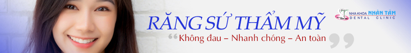 Trồng răng sứ ngoại nhập