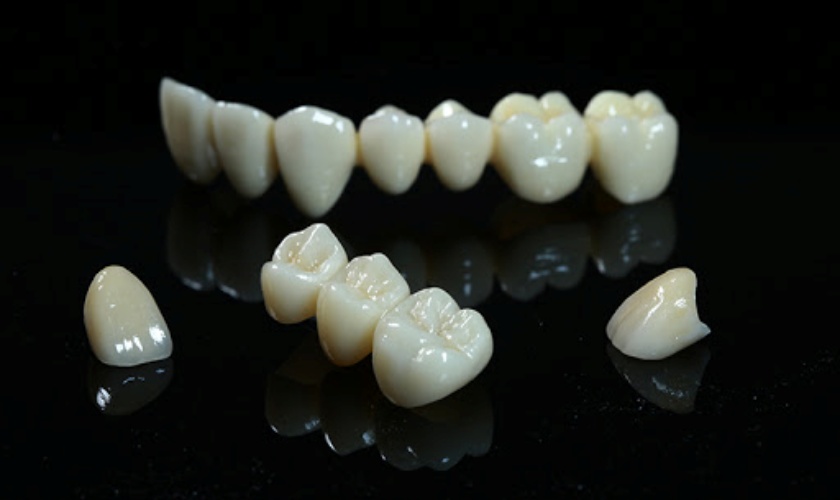 Tìm hiểu quy trình và giá răng sứ Zirconia Tìm hiểu quy trình và giá răng sứ Zirconia