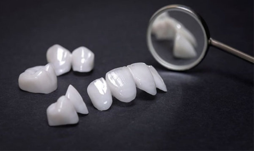 Tư vấn: Răng sứ Emax có bền không? Làm răng sứ thẩm mỹ chất lượng tại HCM ở đâu?